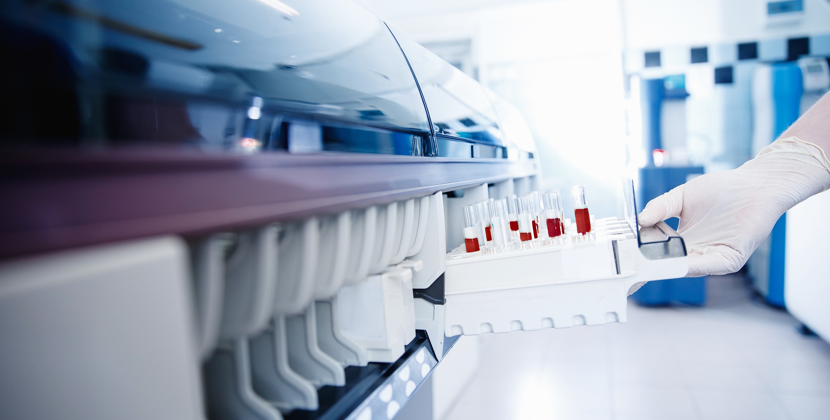 bigstock-Scientist-Downloads-Blood-Samp-362491783
